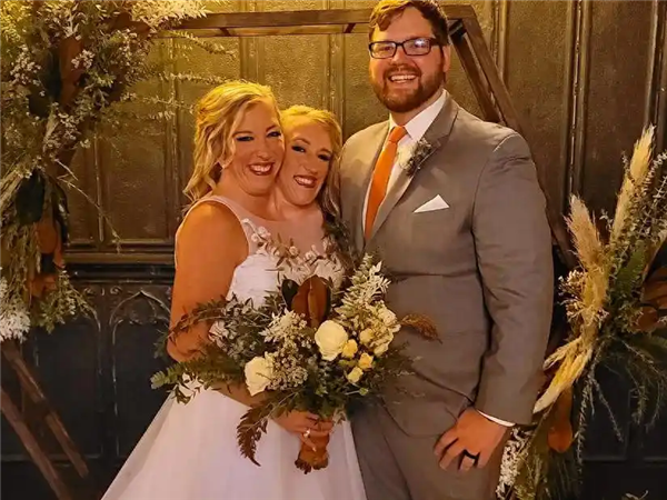 美国连体姐妹“3人婚姻”引热议 姐姐网恋奔现刚结婚 妹妹坚决不婚