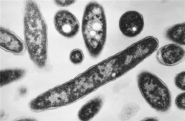 严重细菌性肺部感染！纽约爆发军团菌：67人患病 3人死亡