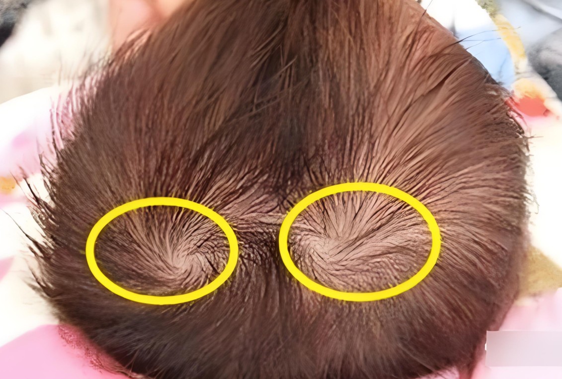 孩子头上有两个旋代表什么？智商测试结果惊人