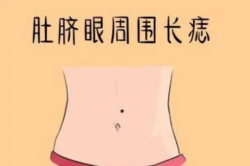 肚脐周围有痣代表什么？这三种痣相最旺夫