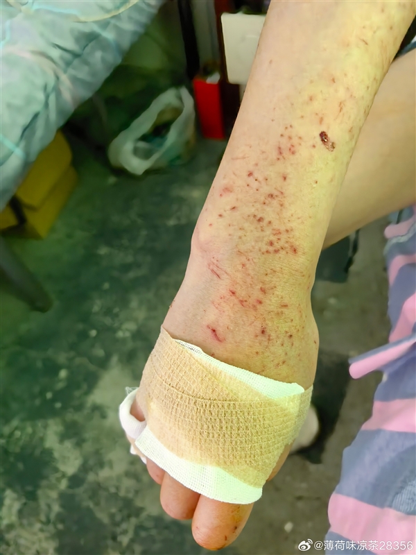 男子和女友开哈弗猛龙滚落80米悬崖 二人仅手臂轻微擦伤！长城魏建军：万幸人没事