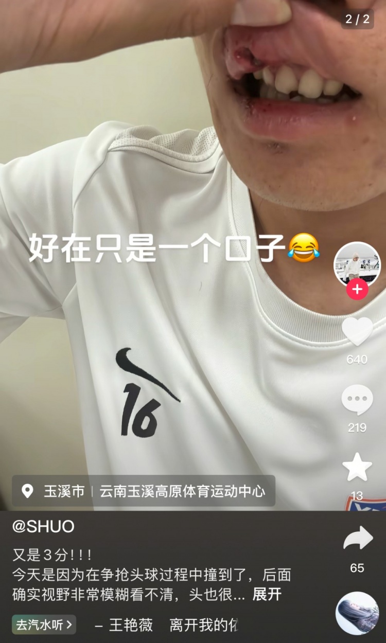 玉昆后卫晒受伤照：提前换下因争头球撞到了 视野模糊看不清&头晕