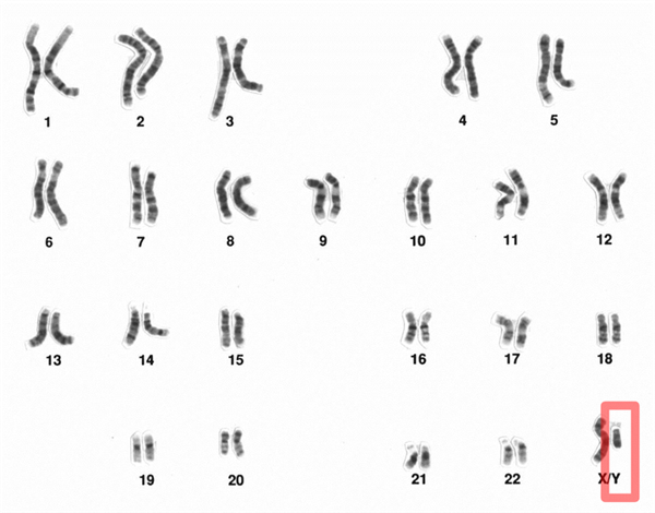 1000多万年后 Y染色体可能要消失 到时男性会怎么样