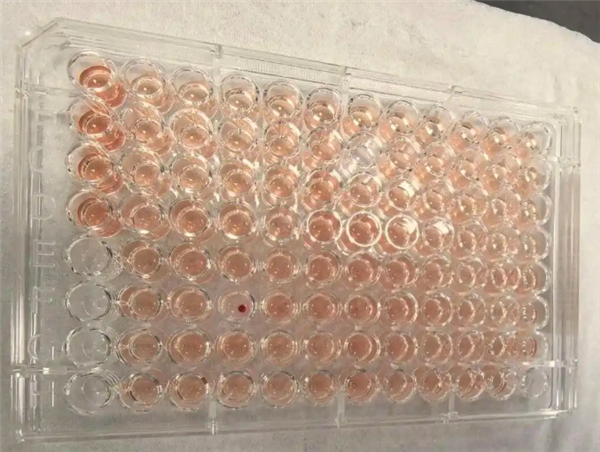 比“熊猫血”罕见百倍！广东顺德发现一例“钻石血”