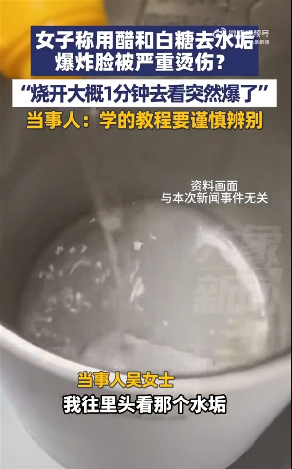 女子用醋加白糖去水垢致爆炸烫伤 当事人：烧开大概1分钟爆了 学的网上教程