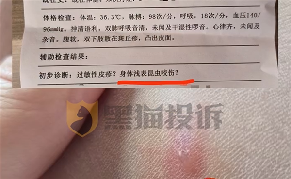 女子住酒店被跳蚤咬70多个包：酒店没赔偿 挂号费都是自己出的