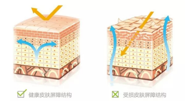 2元一块的硫磺皂 是皮肤病“神器”还是毁肤“杀手”