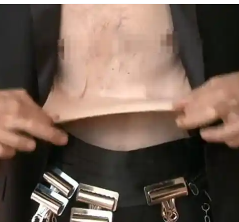 世界上皮肤最有“弹性”的男子 看完可能整个人都不好了