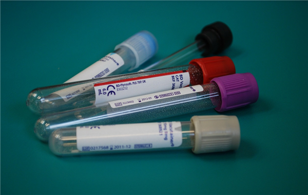 这6种病听起来吓坏人 但基本不用治:别再花冤枉钱了!