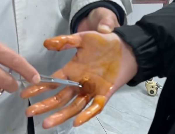 男子徒手摸灭火毯双手被刺钻心疼：主体材质玻璃纤维 需握黑色拉带