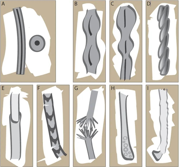 头发开叉其实是种病，很多人忽视了！3步就能改善