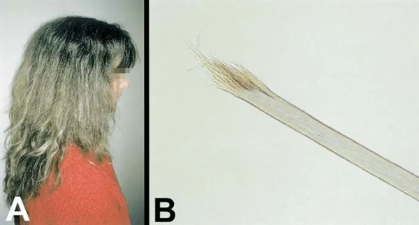 头发开叉其实是种病，很多人忽视了！3步就能改善
